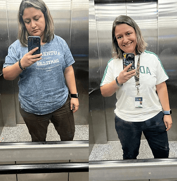 Antes e Depois Carol 1